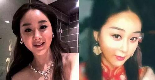 娱乐圈女星癌症爆料视频,勇敢面对，共筑希望之光